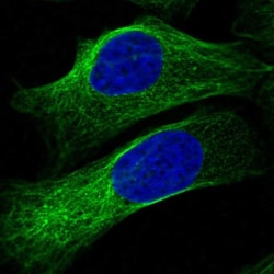 PGAP2 Antibody, Novus Biologicals:Antibodies:Primary Antibodies